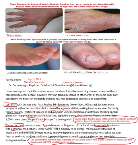 X-RealSAMPLE-SecondOpinion-REFERRAL-WinstonVO-TineaManuum-FungalSkinInfection-Hand-Feet-July2025-MsSUONG X-RealSAMPLE-SecondOpinion-REFERRAL-WinstonVO-TineaManuum-FungalSkinInfection-Hand-Feet-July2025-MsSUONG